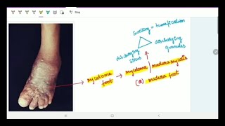 Subcutaneous Deep Mycoses  Microbiology  Image based discussion [upl. by Dnana457]