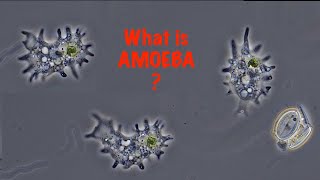 What is Amoeba [upl. by Alik298]