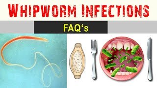 Whipworm infections  Frequently Asked Questions And Answers [upl. by Lapotin]