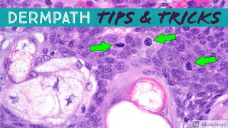 Dermatopathology Practical Tips amp Tricks for Pathology amp Dermatology [upl. by Nahpos]