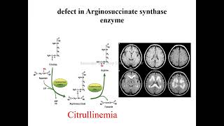 citrullinemia [upl. by Fesoj]